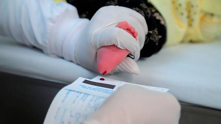 Centros de salud de la SSM aplican sin costo el tamiz neonatal