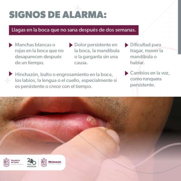 Estos hábitos te pueden provocar cáncer de boca y lengua
