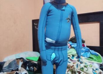 Chuchito Lanza un Llamado de Auxilio: ¡Tu Ayuda es Vital!