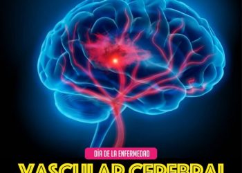 Cómo identificar signos de alarma de una enfermedad vascular cerebral