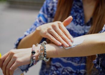 SSM llama a prevenir el sarpullido por altas temperaturas